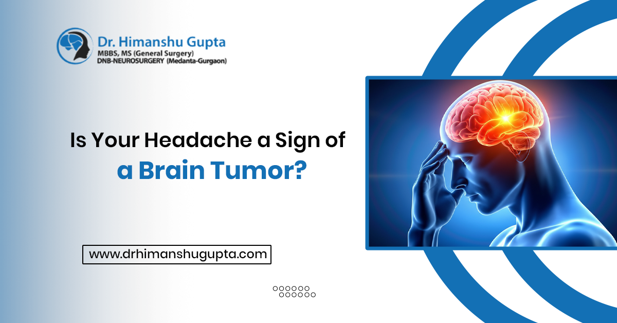 Is Your Headache A Sign Of A Brain Tumor?