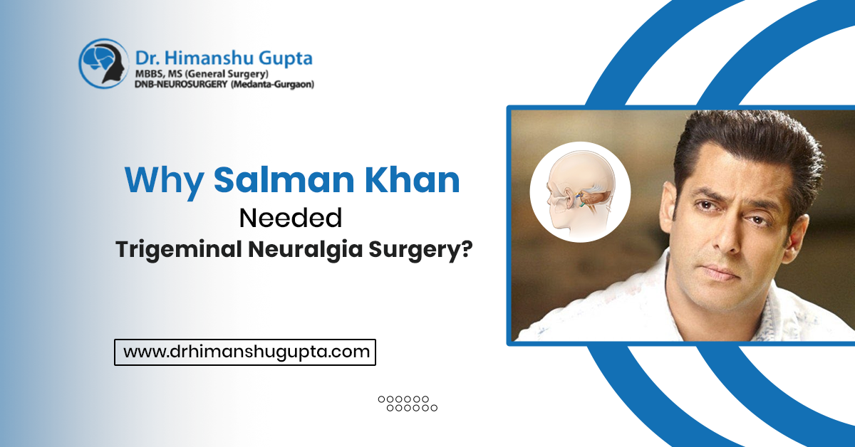 Why Salman Khan Needed Trigeminal Neuralgia Surgery?